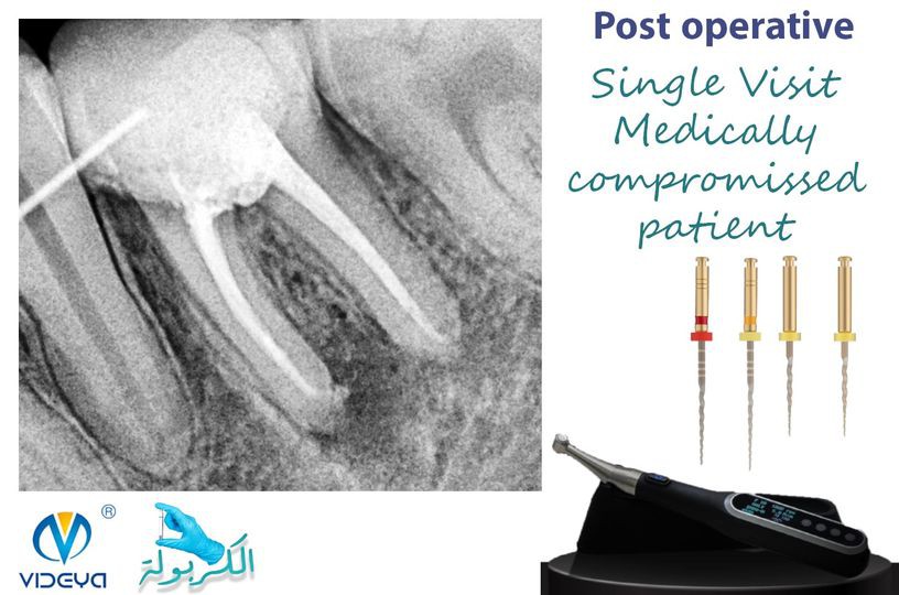 34522796158237405210876242659000819018861138n